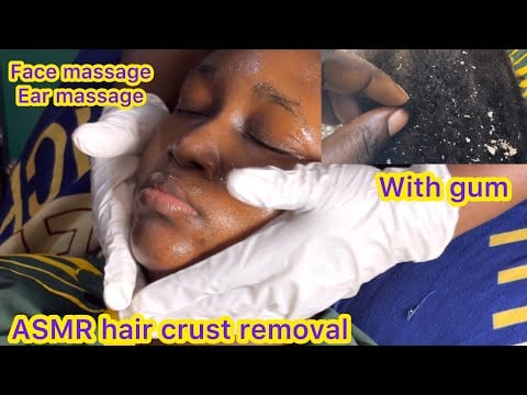 ASMR✨GUM CRACKING WITH HAIR CRUST PICKING, FACE AND EAR MASSAGE, YOULL BE RELAXED IN A MINUTE