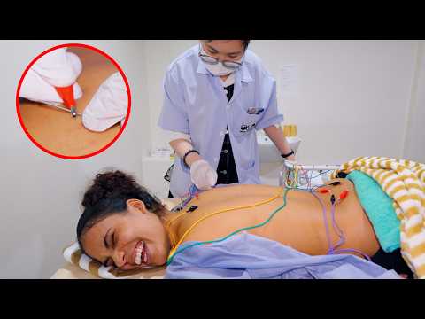 ASMR: ⚡ INSANE Chinese ELECTRIC ACUPUNCTURE Fire Cupping Chiropractic Massage