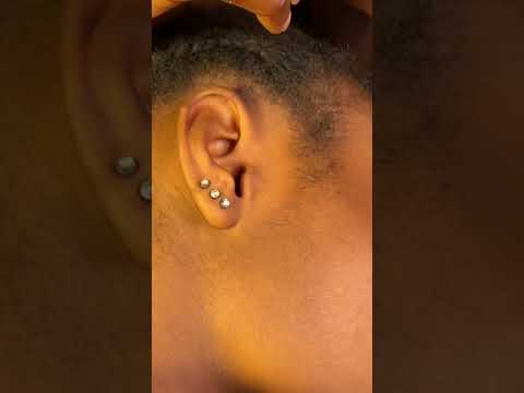 most realistic ear cleaning asmr #asmr #earpicking #sleepaid #earcleaning #relax #earpick