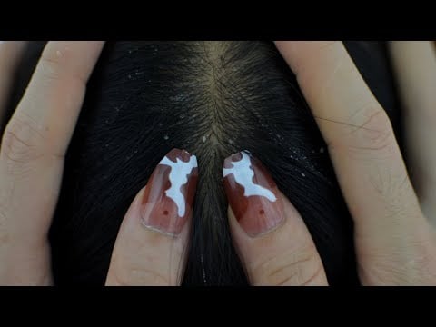 ASMR Relaxing Scalp Check, Scalp Massage, Medical Scalp Treatment For Sleep