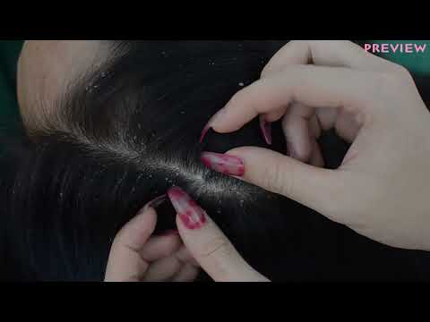[ ASMR ] I Check Your Scalp With Long Nails Relaxing For Sleep ( Scratching, Hair Parting  )