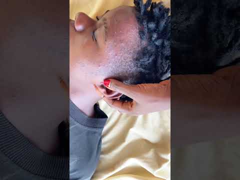 The Perfect deep ear cleaning and nitpicking #asmr #tingling #nitpicking #asmrvideos #satisfying