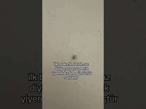 #keşfet #makyaj #youtubeshorts #dişteli #viral
