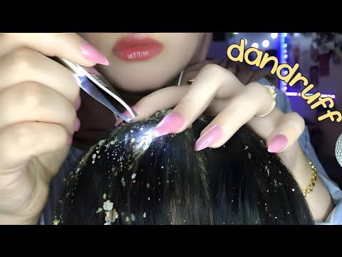 ASMR Dandruff Removal With Mouth Sounds 🍪💦 Scalp Massaging And Scratching For Deep Sleep 💆🏻‍♀️