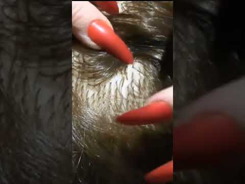 ASMR Sleep Inducing Scalp Check with Long Nails #shorts