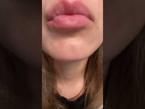 Kisses just for you 🥰
