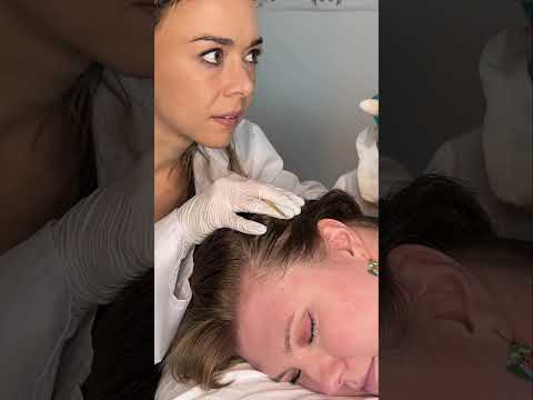 Asmr scalp 💆🏻‍♀️ #asmr #asmrsounds #asmrvideo #relax #relaxing #satisfying #hair #relax