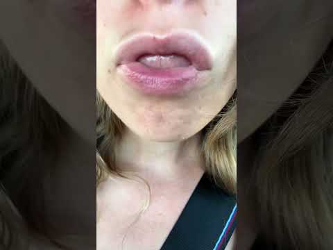 Can I have a kiss?