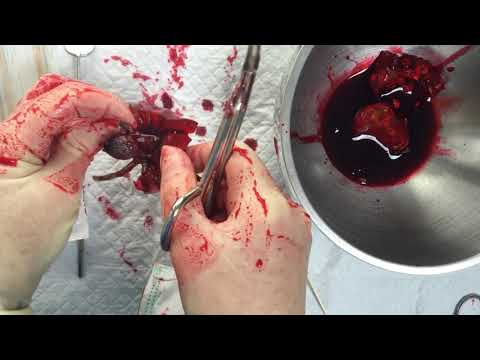 SURGICAL GLOVES ✋  RP🩸  BLOODY AFTER  A  MAJOR SURGERY 🏥  [[ASMR]]