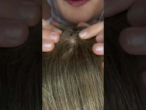 Let me check your hair 💆🏻‍♀️🐜 #asmr #satisfying #relax #shorts