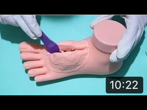 ASMR cirurgia no pé