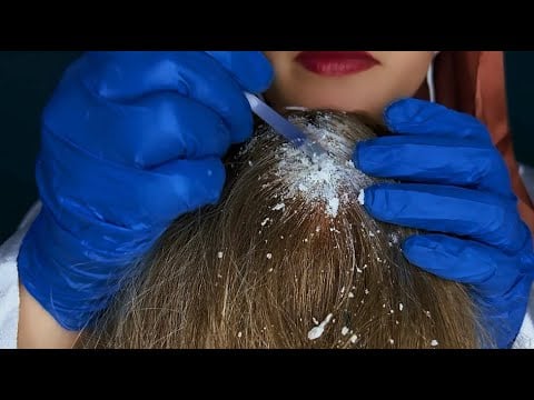 ASMR Scalp Check & Dandruff Removal (head massage) very relaxing