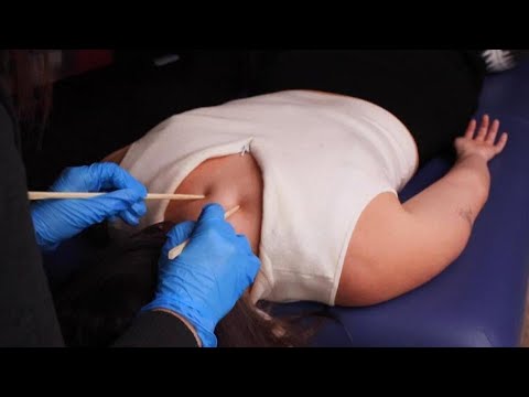 [ASMR] Back Sensory Exam and Point Therapy Treatment on @emvyASMR  [Strange Healing Technique]