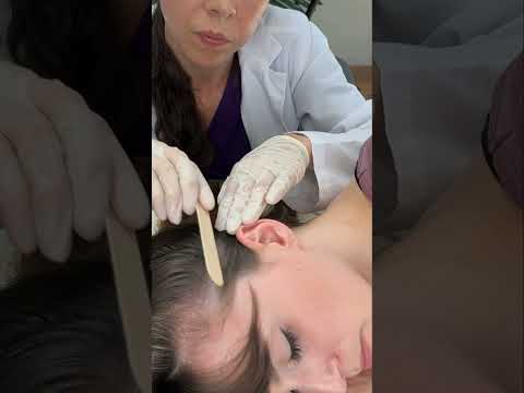 Asmr scalp tingles #asmr #asmrsounds #asmrvideo #relax #relaxing #satisfying #hair #sleep #tingles