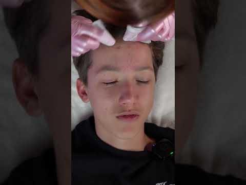 ASMR Pimple Popping