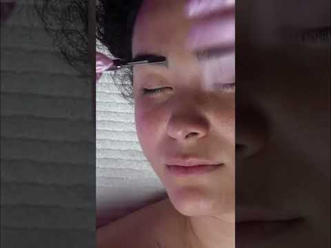 Shocking Dermaplaning Results: Watch This Transformation! #shorts