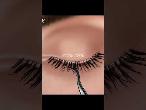 Eye infection Treatment animation,eye stone removal animation#animation #asmr #asmrsounds #trending