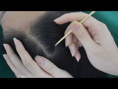 ASMR Real Person Hair Hlay, Hair Parting, Scalp Scratching Tingly For Headache Relief ( No Talking )