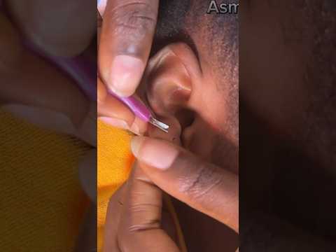 ASMR LOOKING IN YOUR EARS AND CLEANING IT, FACE NITPICKING, AGGRESSIVE SCALP SCRATCHING WITH GUM.
