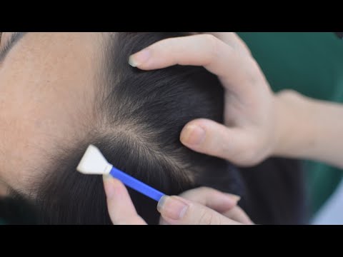 ASMR Hair Parting No Talking, Real Person Scalp Scratch, Scalp Massage For Reduce Headache