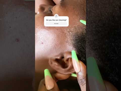 ASMR SUPER ATTENTIVE DEEP EAR CLEANING #asmrshort