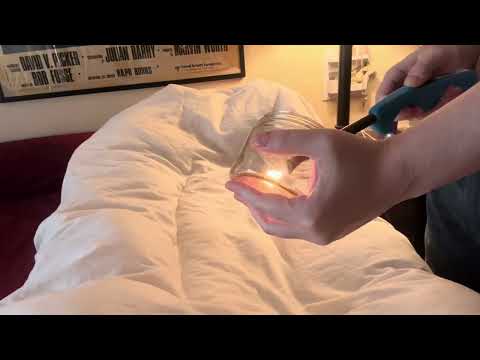 Fire Cupping and Skin Pulling | ASMR role play 