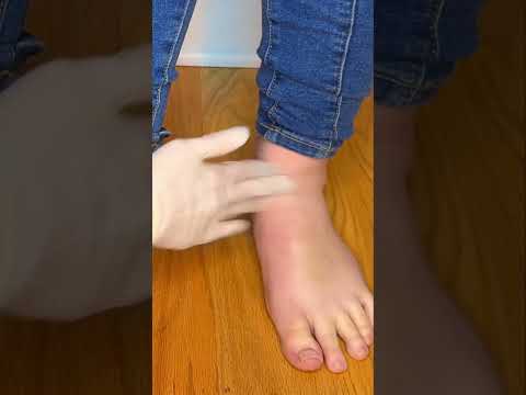 Asmr TSA foot inspection #asmr #relaxing #satisfying #sleep #asmrvideos #relax #asmrvideos #feet