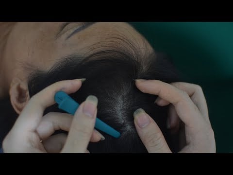 ASMR Scalp Massage,Tingles Scalp Scratching No Talking, Therapy Sounds For Cure Insomnia