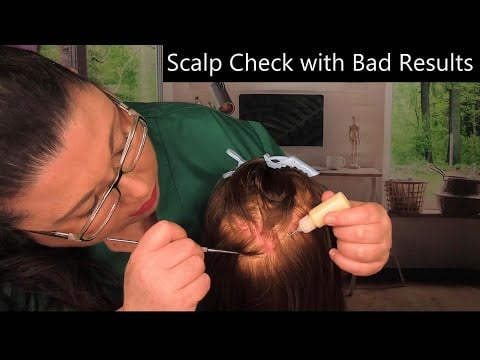 ASMR Scalp Check with Bad Results (Scalp Treatment, Scalp Massage, Whispering) Medical Roleplay