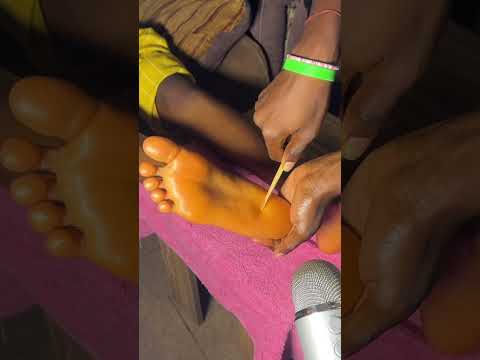 ASMR FOOT/LEG MASSAGE, INGROWN TOENAILS REMOVAL, PEDICURE, FOOT/LEG SCRATCHING, GUM CHEWING