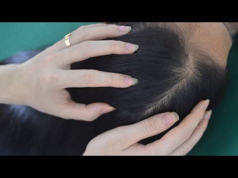 ASMR Head Scratching Massage, Real Person Hair Combing, Therapy Sounds For Headache Relief