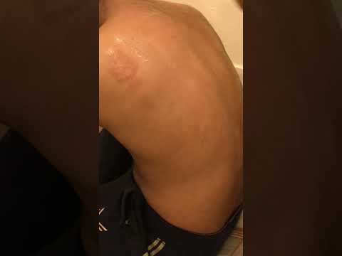 Back massage #massage #backmassage #backcracking #asmrsounds #lahoribarber #relaxing #asmr #chest