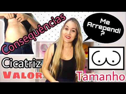 COLOQUEI SILICONE COM 17 ANOS E PERDI A SENSIBILIDADE! (ANTES E DEPOIS) | Bianca Peres