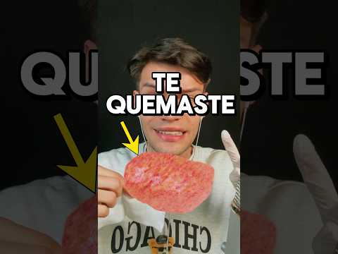 TE QUEMASTE Y TE CURO #asmr #shorts #asmrvideo #comedia