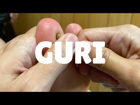 ぐりぐり足つぼ | 足つぼ初めての人にぐりぐり施術してみた