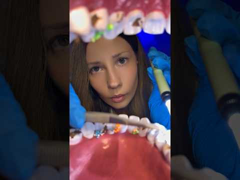 ASMR Dentist Cleaning Your Teeth 🦷 Doctor Roleplay #asmr #doctor #dentist #dental