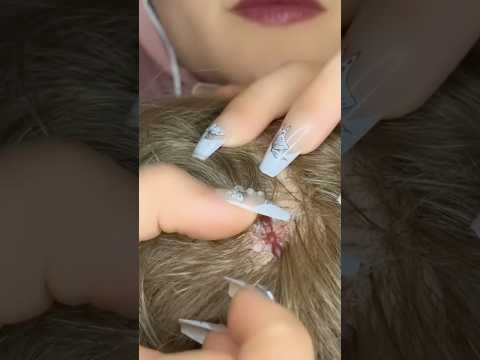 ASMR BUGS 🐜🔍#asmr #asmrmassage #satisfying #relax #asmrscratching #shorts #asmrtingles