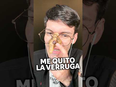 Me QUITO la verruga de la nariz #asmr #shorts #asmrsounds #comedia