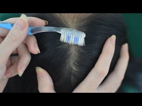 ASMR Head Scratching, Head Massage With Toothbrush For Relaxation ( No Talking )