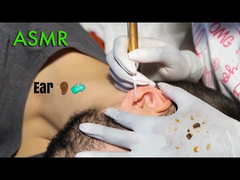 ASMR Ear Cleaning - DEEP & THOROUGH