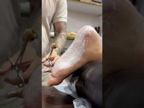 Have you ever seen a windstorm like this?!#shorts #asmr #viralshorts #youtubeshorts#cupping #fyp