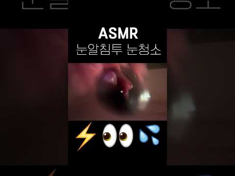 눈알까지 시원하게 긁어주는 눈청소 ASMR