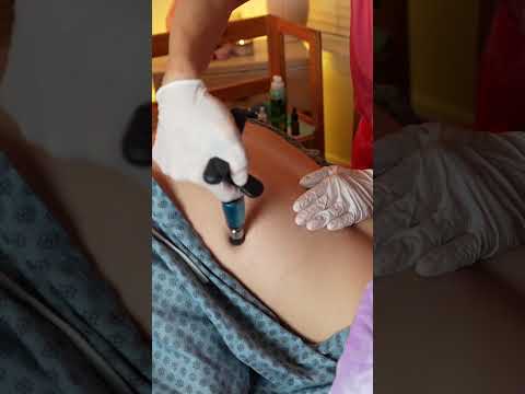 Asmr back exam #asmr #asmrsounds #asmrvideo #relaxing #relax #satisfying #satisfyingvideo #tingles