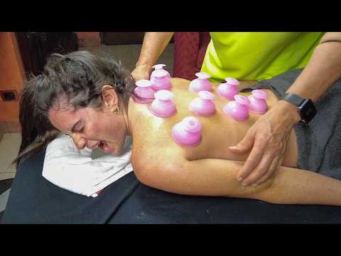 ASMR: Intense & Deep Back Massage with Cupping | Relaxation & Pain Relief