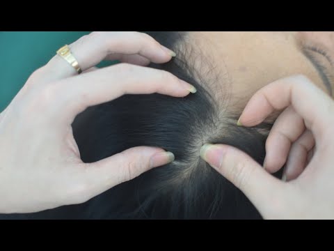 ASMR Head Scratching Real Person With Breathing, Snoring Sounds For Anxiety Relief