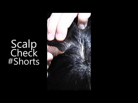 ASMR Tingly Scalp Check (NO TALKING) #Shorts