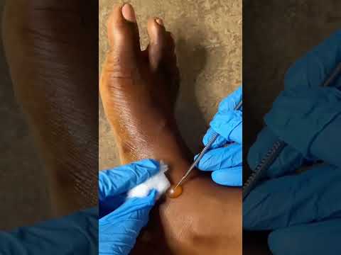 Asmr luxury effective leg treatments with skincare -Pus #asmr #asmrearcleaning #skincare #tingly