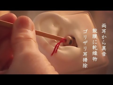 ASMR 【SR3D】両耳から異音 鼓膜にガッサガサ耳垢ゆっくりとごっりごりに耳掃除 Noise from both ears/Q-tip