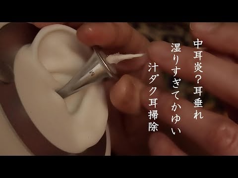 ASMR 鼓膜炎?急性中耳炎!?耳垂れ(湿り)すぎてかゆい？汁ダクを綿棒でこすり取るような耳掃除・竹耳かきすりすりQ-tips earpick Wet ear cleaning