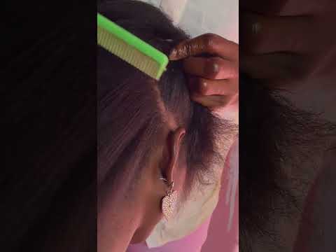 Asmr lice check on scalp #tingling #licecheck #licepicking #scalpscratching